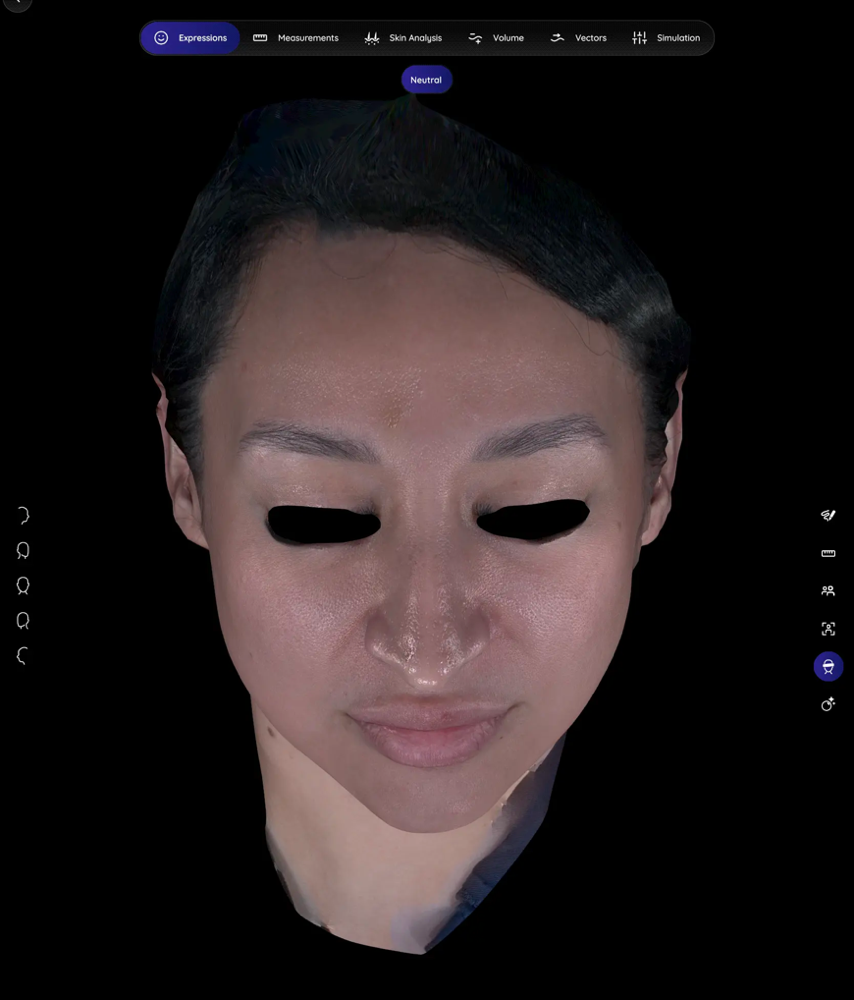 Aura 3D facial imaging digital twin viewed from the front