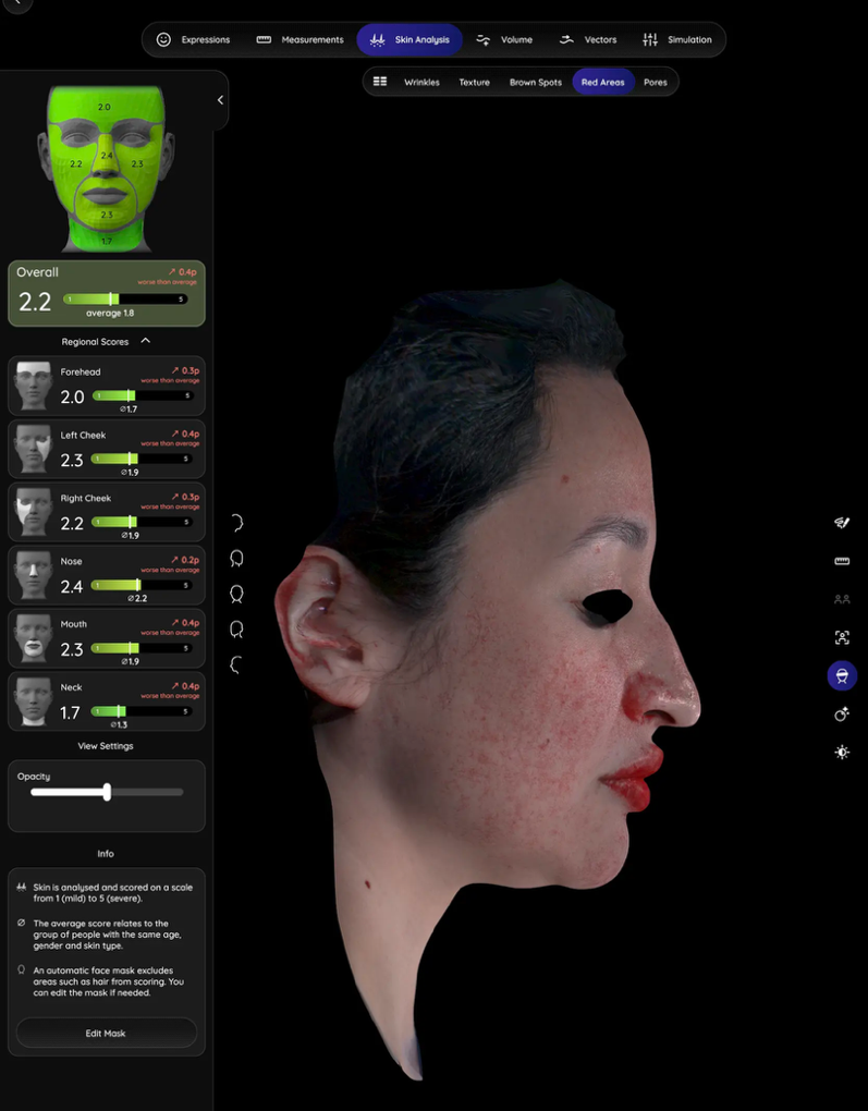 Aura 3D facial imaging side profile and facial proportions