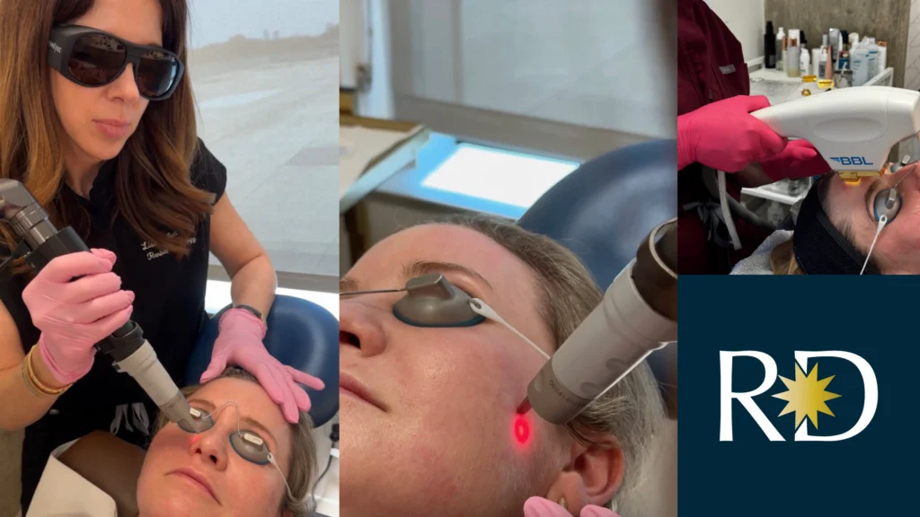 Laser treatments varieties by board-certified Dr Lisa Guidry Pruett | Revival Dermatology