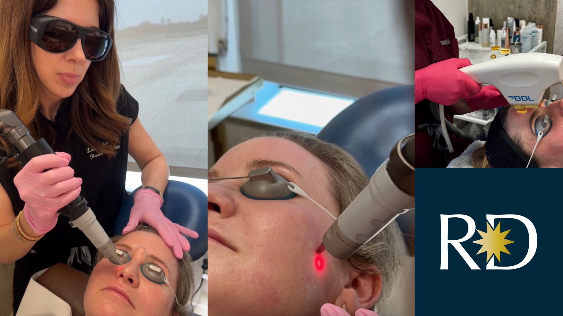Laser treatments varieties by board-certified Dr Lisa Guidry Pruett | Revival Dermatology